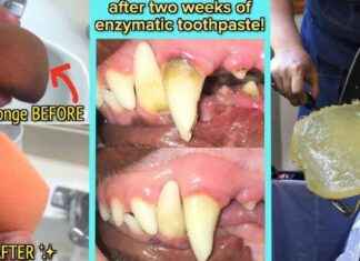 43 Produkte mit erstaunlichen Ergebnissen: Diese Fotos lügen nicht 43-produkte-mit-erstaunlichen-ergebnissen-diese-fotos-lgen-nicht