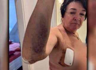 Gefährliche Hundeattacke | SAT.1 NRW – Infopage zur Sendung gefhrliche-hundeattacke-sat1-nrw-nfopage-zur-sendung