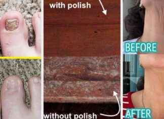 37 Problem-Lösungsprodukte, die wirklich funktionieren – Beweisfotos 37-problem-lsungsprodukte-die-wirklich-funktionieren-beweisfotos