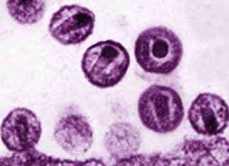 Die Wahrheit über die AIDS-Verschwörung: Ärzte im Zwielicht die-wahrheit-ber-die-ads-verschwrung-rzte-im-zwielicht