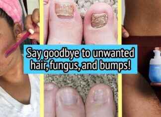 33 Lösungen für lästige Körperprobleme: So beheben Sie Ihre Beschwerden effizient 33-lsungen-fr-lstige-krperprobleme-so-beheben-sie-hre-beschwerden-effizient