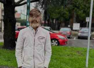 Das haarigste Gesicht der Welt: Lalit (18) feiert sich selbst das-haarigste-gesicht-der-welt-lalit-18-feiert-sich-selbst