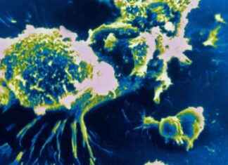 Heilung von Krebszellen: Durchbruch mit innovativem Therapieansatz heilung-von-krebszellen-durchbruch-mit-innovativem-therapieansatz