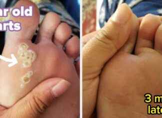 35 Produkte, die du schon vor Jahren haben wolltest – Vorher-Nachher-Fotos beweisen es 35-produkte-die-du-schon-vor-jahren-haben-wolltest-vorher-nachher-fotos-beweisen-es